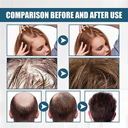 BOHHO AccretePRO sprej za jačanje kose, prirodni hranjivi sprej za vlasište za finu i Prorijeđenu kosu-2 kom