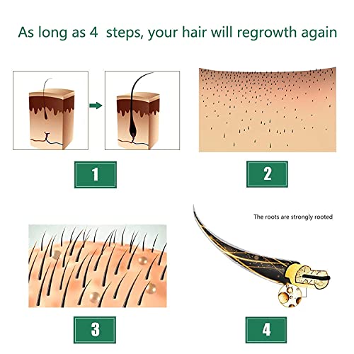 5 pakovanja ulja đumbira za rast kose, Serum za rast kose,Biotin ulje za rast kose,Serum đumbira za rast kose za muškarce i žene,tretman rasta kose, tretman gubitka kose, promoviše gušću, rast kose